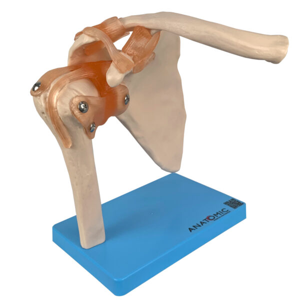Articulação do Ombro com Ligamentos - Imagem 3