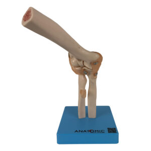 Articulação do Cotovelo com Ligamentos