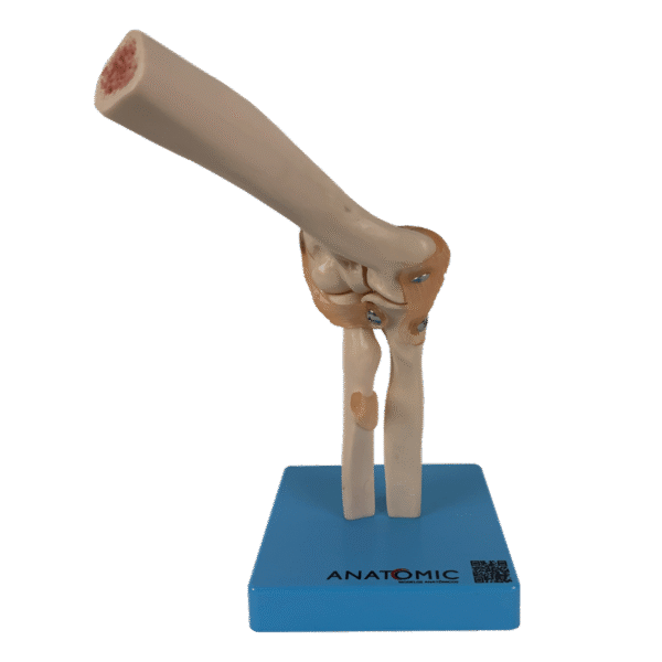 Articulação do Cotovelo com Ligamentos - Imagem 3