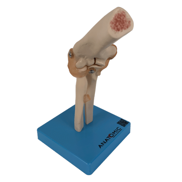 Articulação do Cotovelo com Ligamentos - Imagem 2