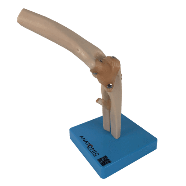 Articulação do Cotovelo com Ligamentos - Imagem 4