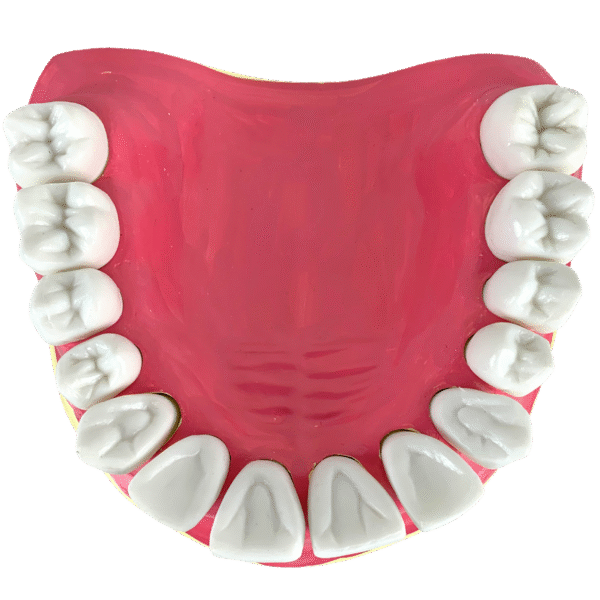 Dentição com Todos os Dentes Removíveis - Imagem 3