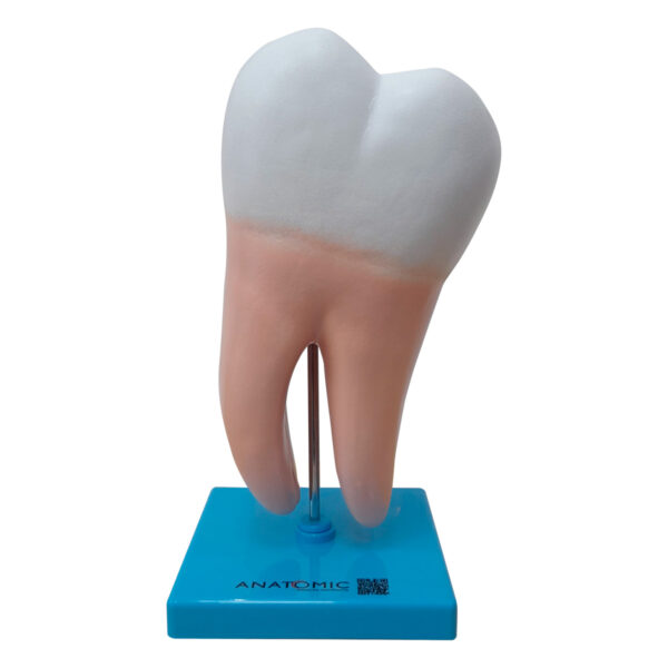 Dente Molar Ampliado – Saudável e com Cárie - Imagem 3