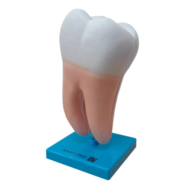 Dente Molar Ampliado – Saudável e com Cárie - Imagem 5