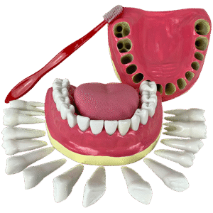 Dentição com Todos os Dentes Removíveis