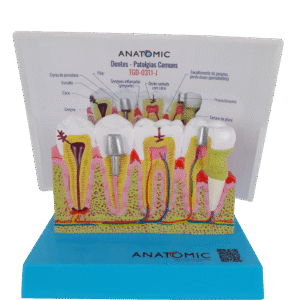 Patologia Dentária e Placa Explicativa