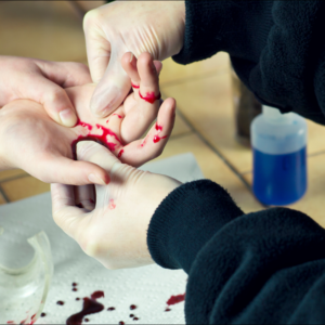 Stop The Bleed